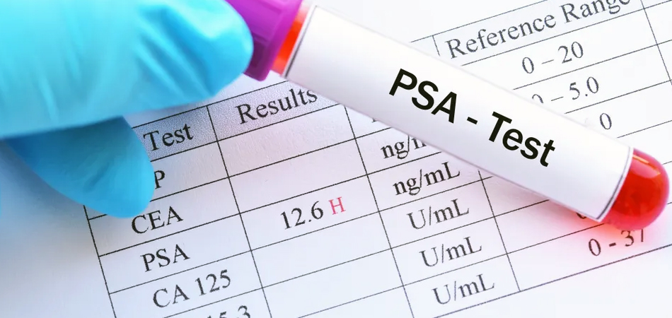 PSA-Test with vial of blood